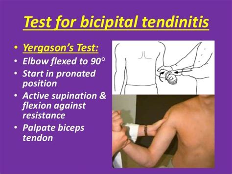 therapy tests for biceps partial tear|positive yergason's test shoulder.